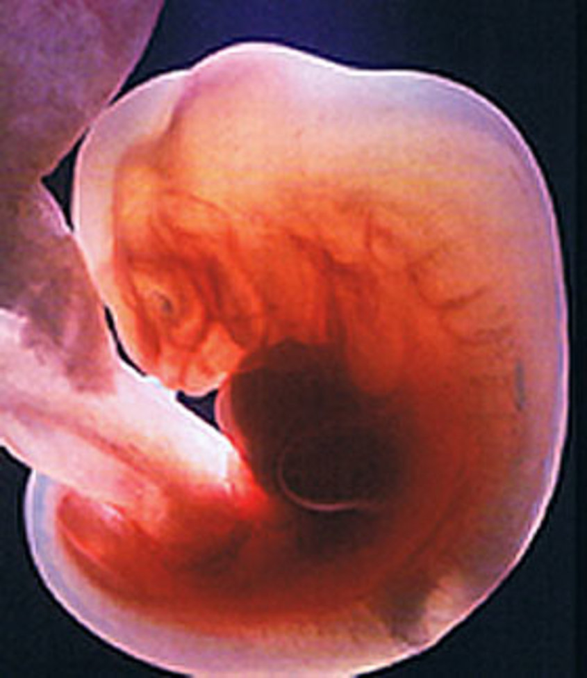 Эмбрион на какой неделе. Зародыш 3-4 недели беременности. Плод на 4 неделе беременности. Плод ребенка на 4 неделе беременности. Эмбрион на 2-3 недели беременности.