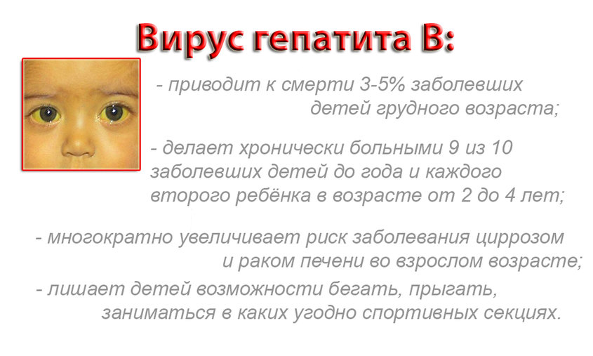 Гепатит б в 1 месяц. Гепатит б симптомы у детей до года. Гепатит б симптомы у детей 3 года. Вирусный гепатит симптомы у детей.